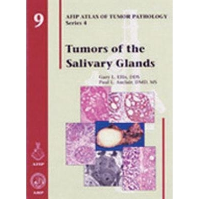 Tumors of the Salivary Glands, 1st Edition