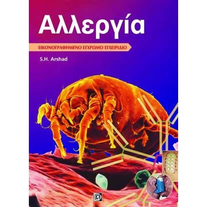 Αλλεργία