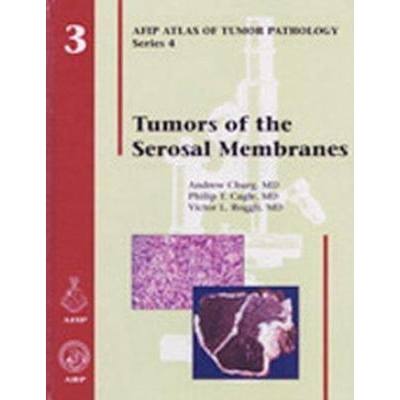 Tumors of the Serosal Membranes, 1st Edition