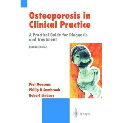 Osteoporosis in Clinical Practice: A Practical Guide for Diagnosis and Treatment, 2nd Edition