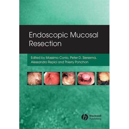 Endoscopic Mucosal Resection