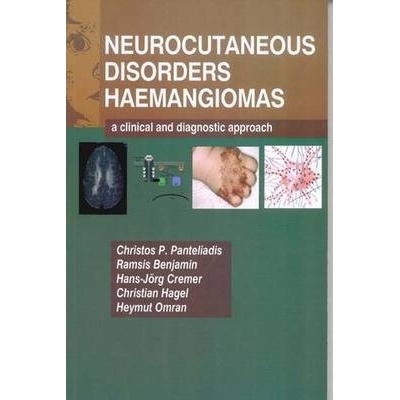 Neurocutaneous Disorders - Hemangomas: A Clinical and Diagnostic Approach, 1st Edition