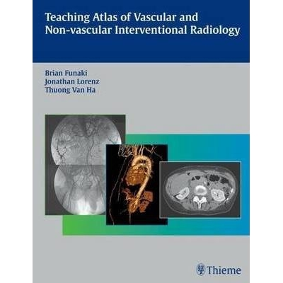Teaching Atlas of Vascular and Non-vascular Interventional Radiology