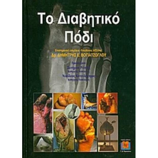 Το Διαβητικό Πόδι