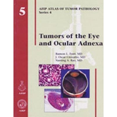 Tumors of the Eye and Ocular Adnexa, 1st Edition
