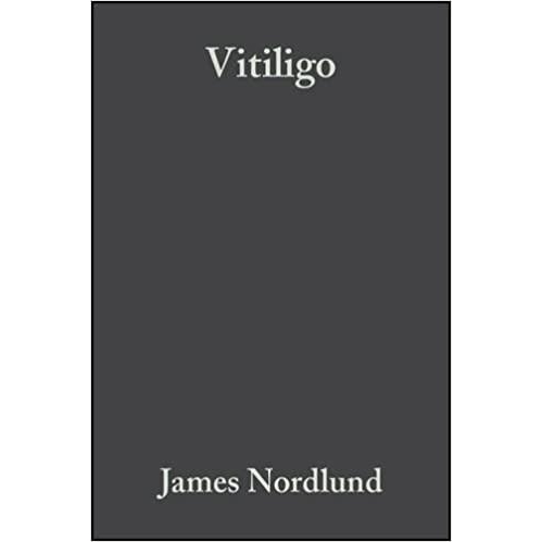 Vitiligo: A Comprehensive Monograph on Basic and Clinical Science