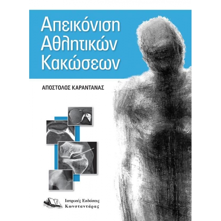 Απεικόνιση Αθλητικών Κακώσεων