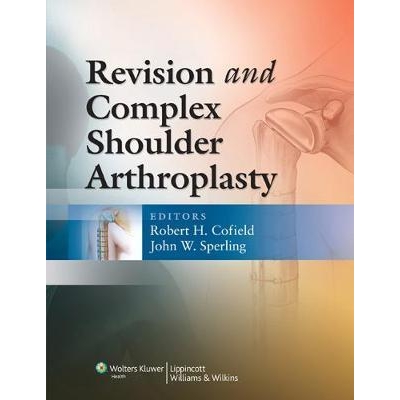 Revision and Complex Shoulder Arthroplasty, 1st Edition