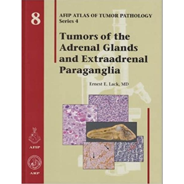 Tumors of the Adrenal Glands and Extraadrenal Paraganglia