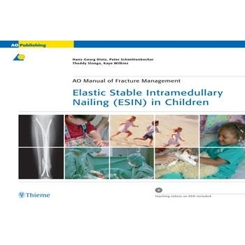 Elastic Stable Intramedullary Nailing (ESIN) in Children