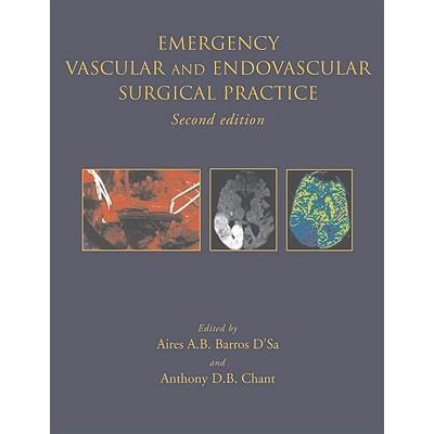 Emergency Vascular and Endovascular Surgical Practice Second Edition, 2nd Edition