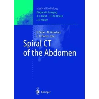 Spiral CT of the Abdomen, 1st Edition