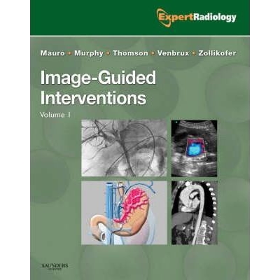 Image-Guided Interventions, 1st Edition