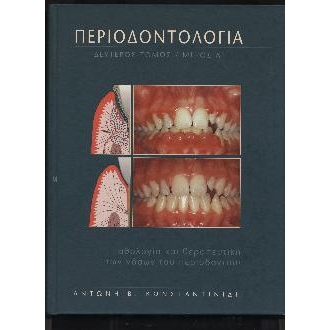 ΠΕΡΙΟΔΟΝΤΟΛΟΓΙΑ Β` Τόμος Α` Μέρος Παθολογία και Θεραπευτική των Νόσων του Περιοδοντίου