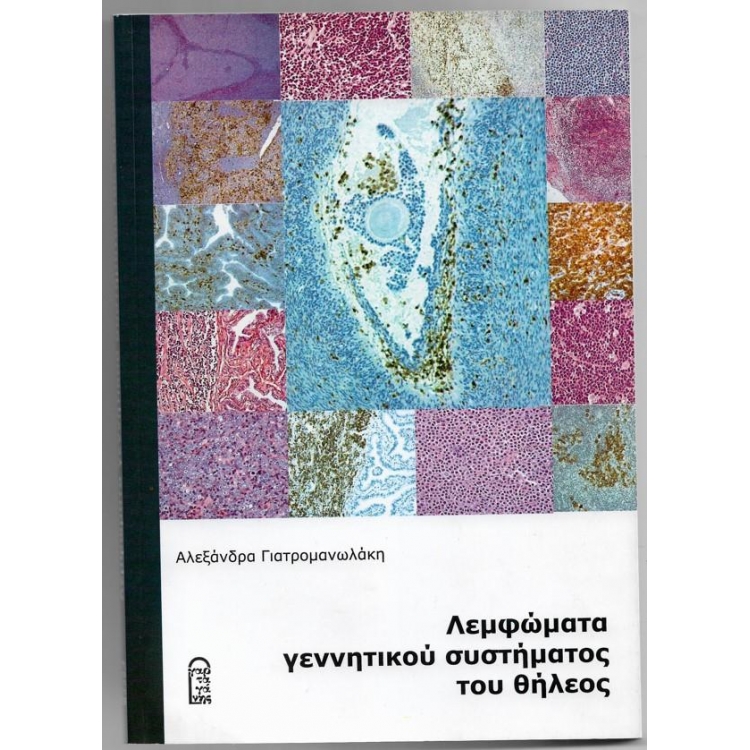 ΓΙΑΤΡΟΜΑΝΩΛΑΚΗ Λεμφώματα Γεννητικού Συστήματος του Θήλεος