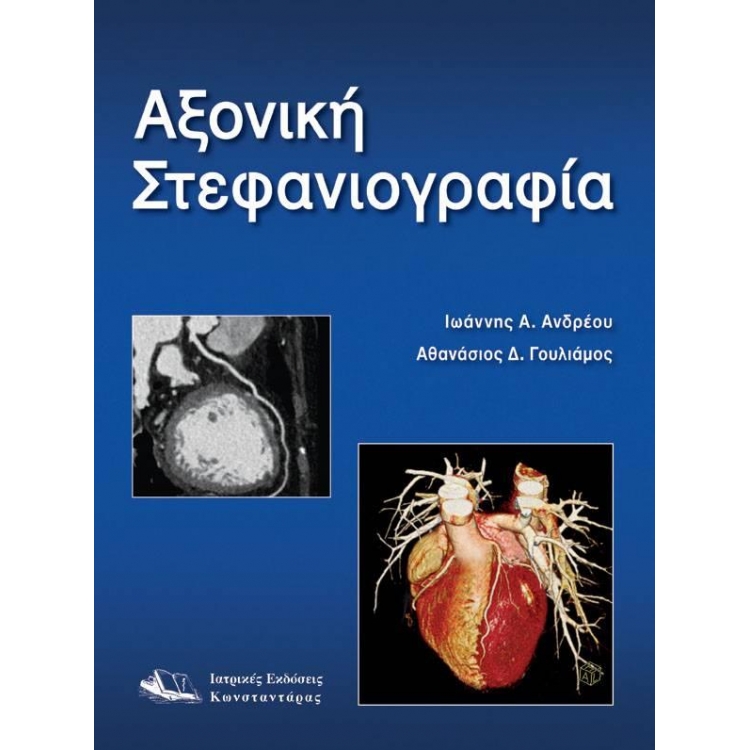 Αξονική Στεφανιογραφία