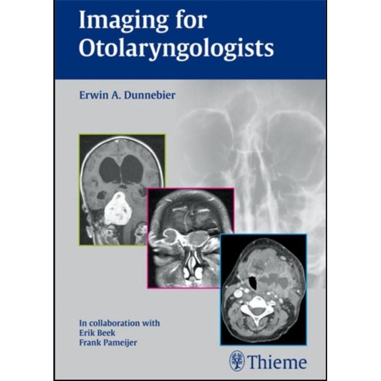 Imaging for Otolaryngologists, 1st Edition