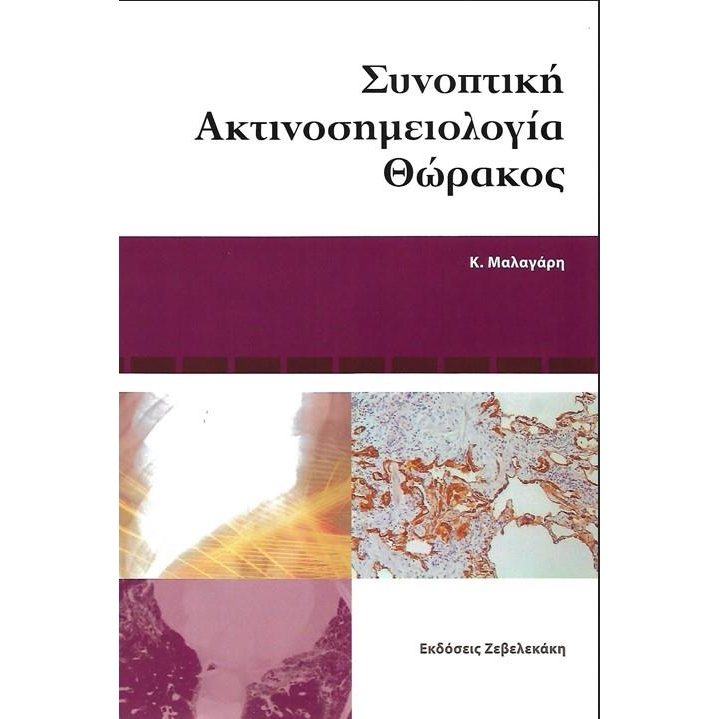 Συνοπτική Ακτινοσημειολογία Θώρακος