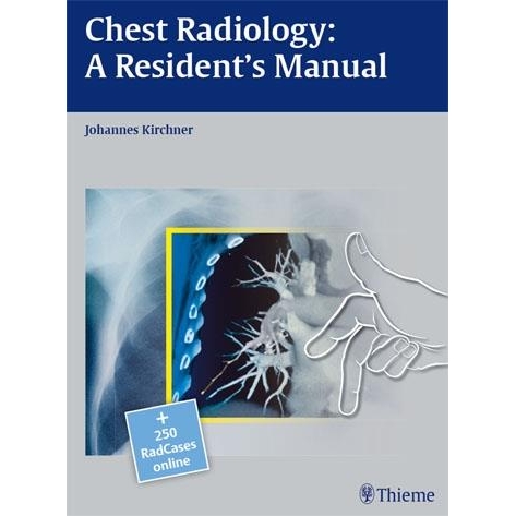 Chest Radiology: A Resident`s Manual