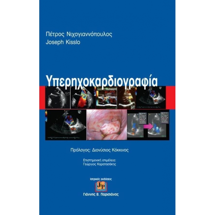 Υπερηχοκαρδιογραφία