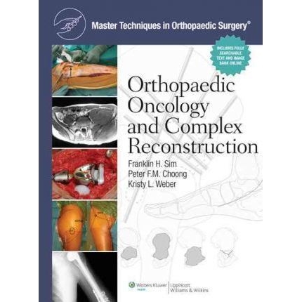 Master Techniques in Orthopaedic Surgery: Orthopaedic Oncology and Complex Reconstruction, 1st Edition