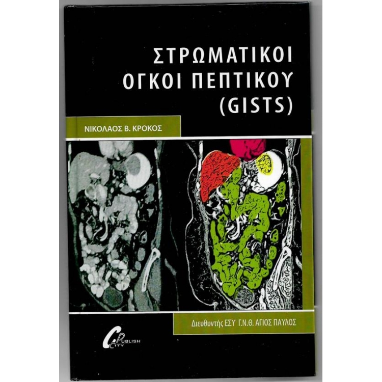 ΚΡΟΚΟΣ ΣΤΡΩΜΑΤΙΚΟΙ ΟΓΚΟΙ ΠΕΠΤΙΚΟΥ (GISTS)