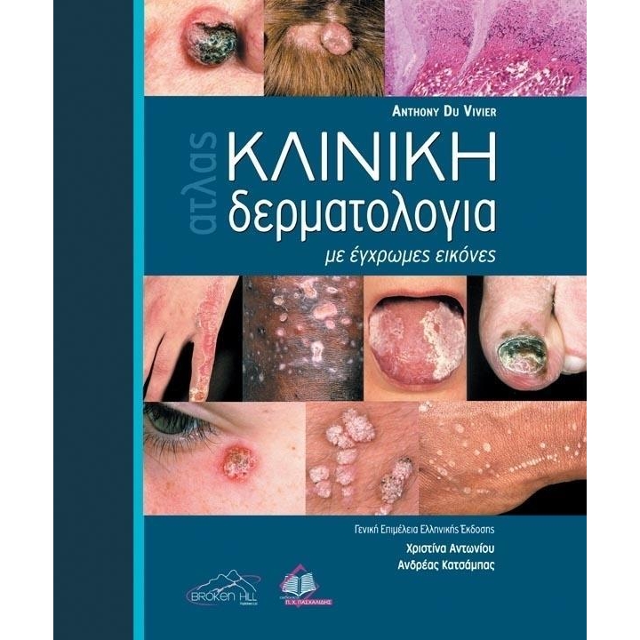 Du Vivier Άτλας  Κλινική ΔΕΡΜΑΤΟΛΟΓΙΑ με Έγχρωμες Εικόνες