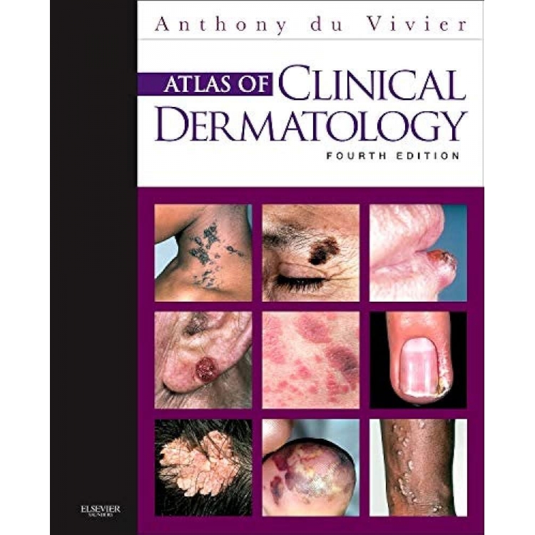 Du vivier Atlas of Clinical Dermatology 4/e