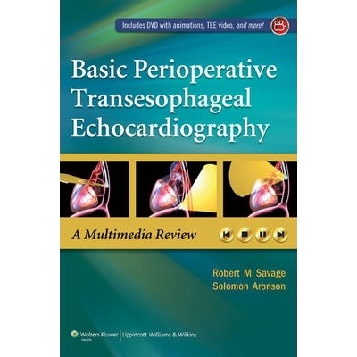 Basic Perioperative Transesophageal Echocardiography, 1st Edition