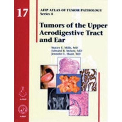 Tumors of the Upper Aerodigestive Tract and Ear, 1st Edition