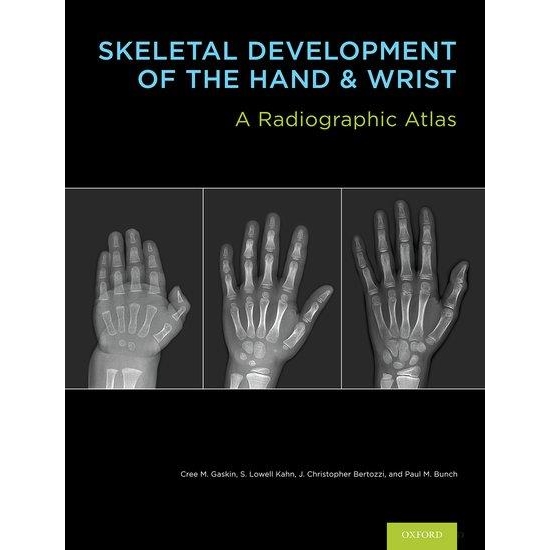 Skeletal Development of the Hand and Wrist