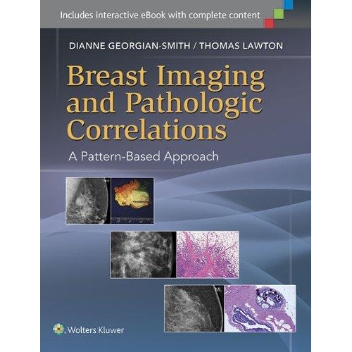Breast Imaging and Pathologic CorrelationsA Pattern-Based Approach, First edition