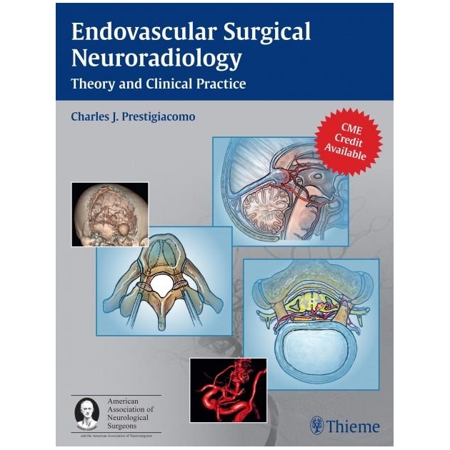 Endovascular Surgical Neuroradiology