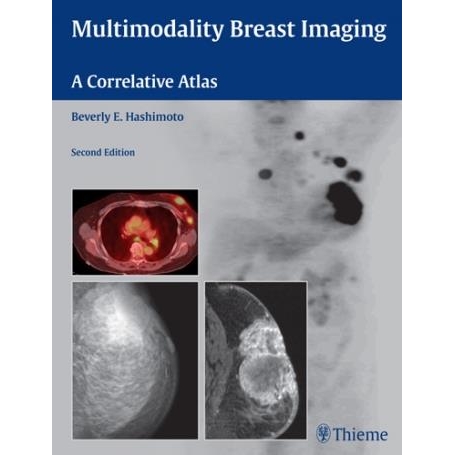 Multimodality Breast Imaging A Correlative Atlas