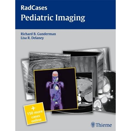 Radcases Pediatric Imaging