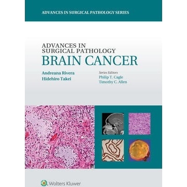 Advances in Surgical Pathology: Brain Cancer
