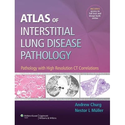 Atlas of Interstitial Lung Disease Pathology: Pathology with High Resolution CT Correlations, 1st Edition