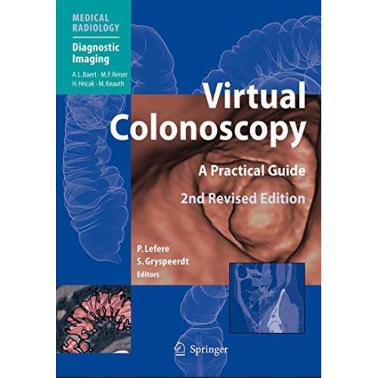 Virtual Colonoscopy: A Practical Guide, 2nd Edition