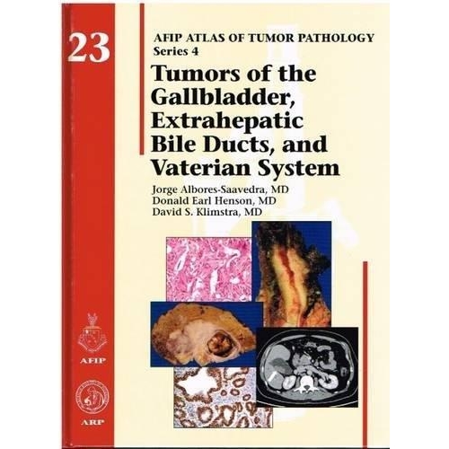 Tumors of the Gallbladder, Extrahepatic Bile Ducts, and Vaterian System