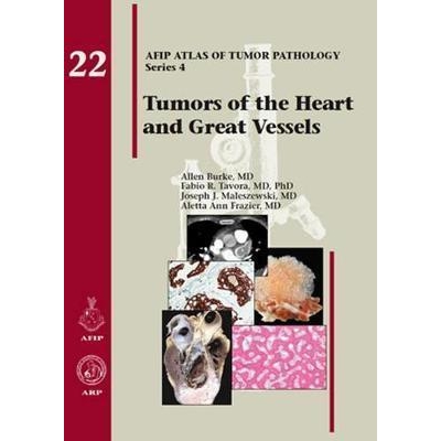 Tumors of the Heart and Great Vessels (Atlas of Tumor Pathology)