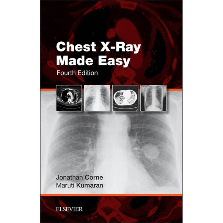 Chest X-Ray Made Easy, 4th Edition