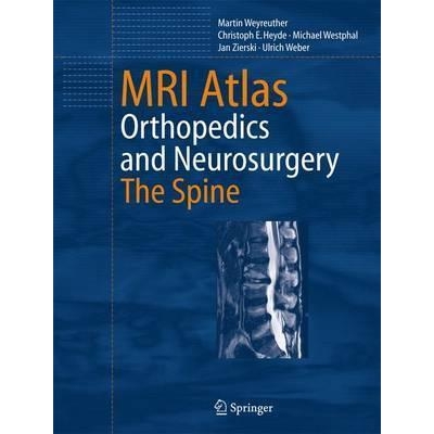 MRI Atlas: Orthopedics and Neurosurgery, The Spine