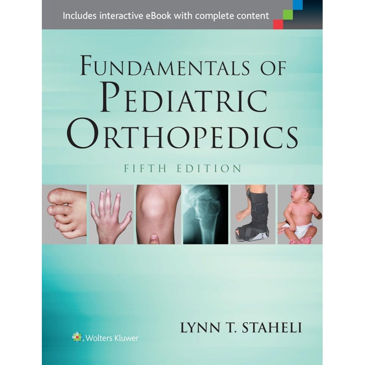 Fundamentals of Pediatric Orthopedics, 5th Edition