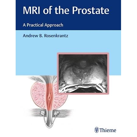 MRI of the Prostate A Practical Approach