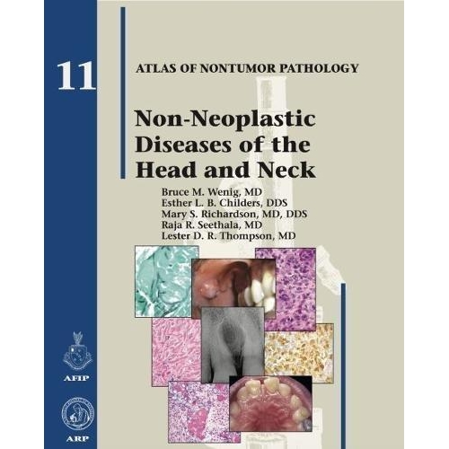 Non-Neoplastic Diseases of the Head and Neck