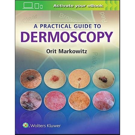 A Practical Guide to Dermoscopy