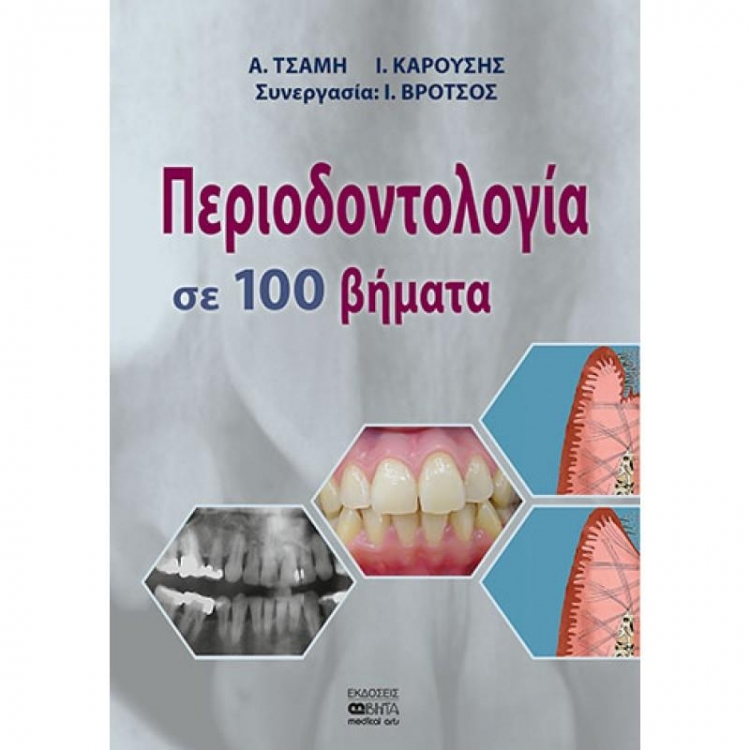 Περιοδοντολογία σε 100 βήματα