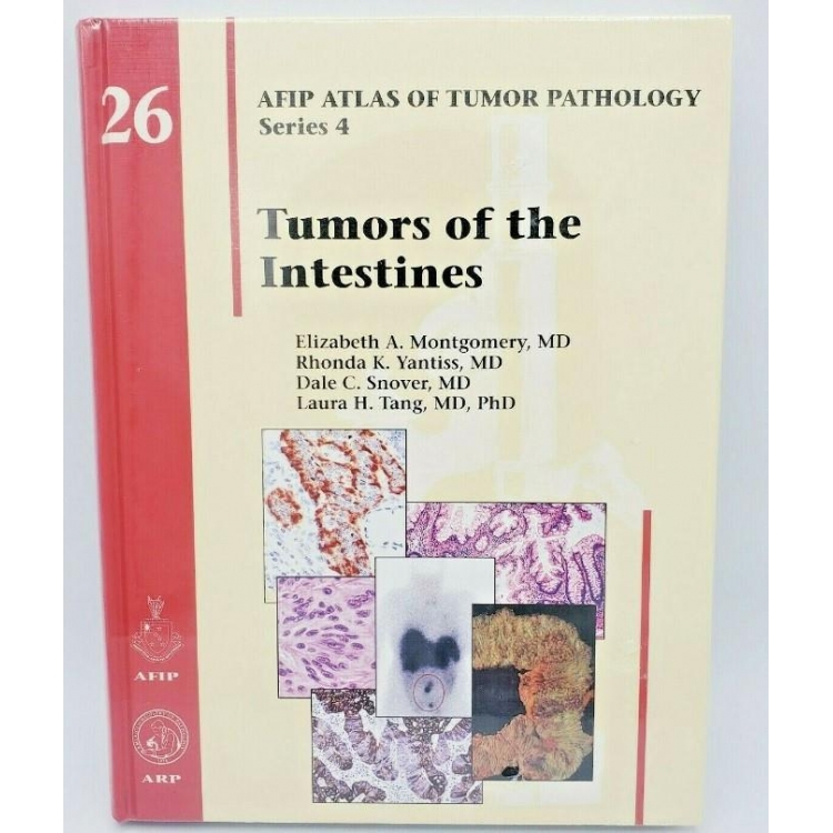 Tumors of the Intestines (Atlas of Tumor Pathology, Series 4, Number 26)