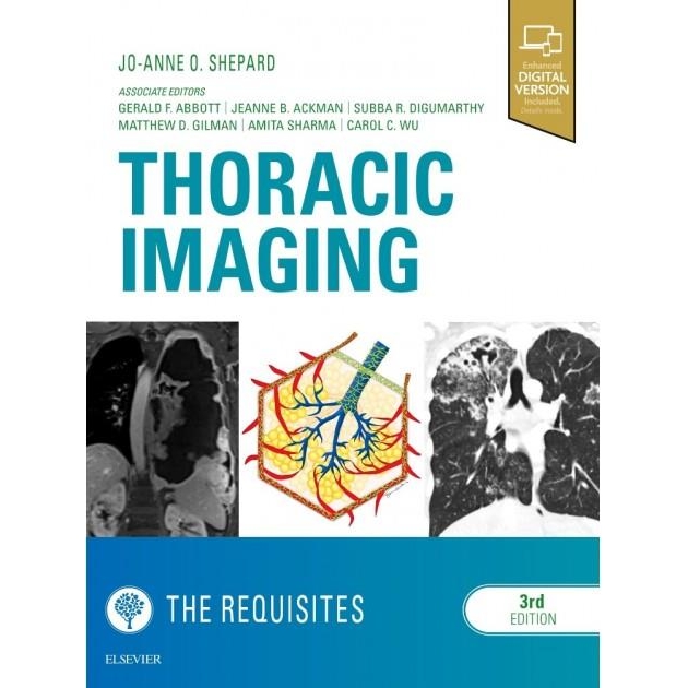 Thoracic Imaging The Requisites, 3rd Edition