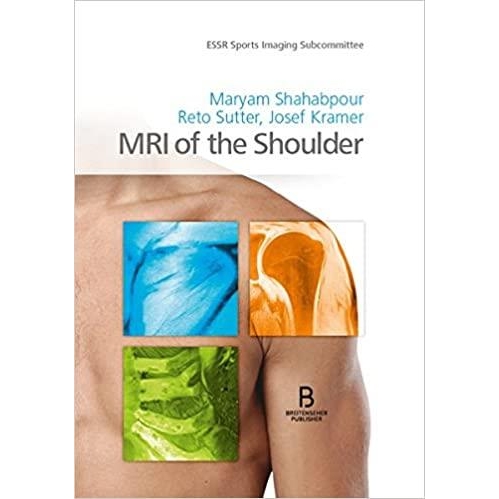 MRI of the Shoulder